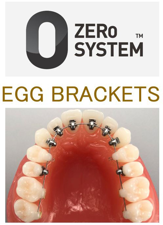 bracket